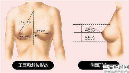 汕头大学医学院非常好附属医院整形美容科美胸吸脂术后评价\医生资料-附整形价格表(费用)