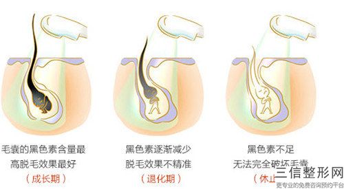 威海市激光脱毛隔十天做收费明细热门项目曝光-威海市激光脱毛隔十天做整形手术价格