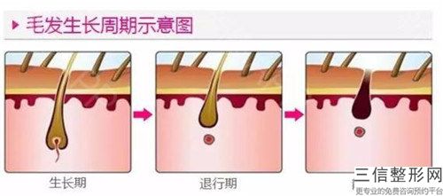 深圳的钻医疗美容诊所价格(价目)表跌楼不容错-秃发手术修复案例