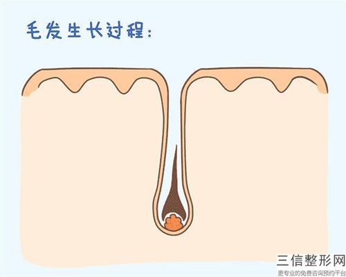 武威晓明整形医院价格(费用)清单项目表一览-私处脱毛案例